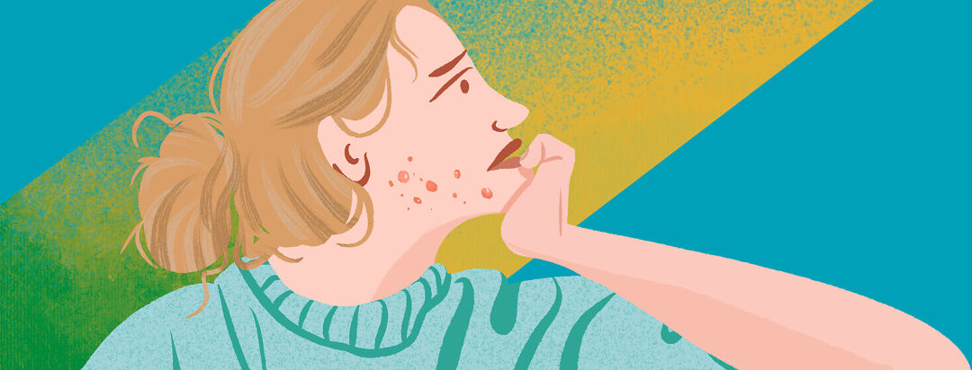 Does Having MASH Cause Breakouts? image
